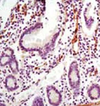 LPP Antibody抗体,orb97535,biorby