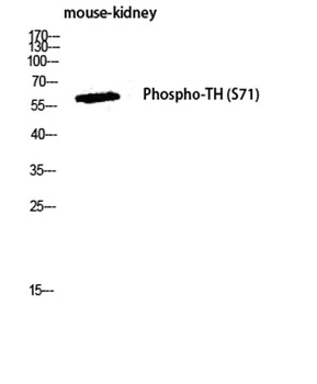 TH (phospho Ser71) rabbit pAb抗
