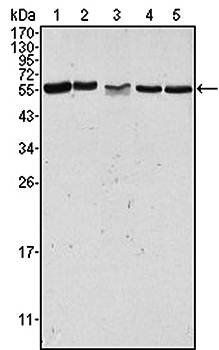 PAK2 Antibody抗体，orb97576，biorb