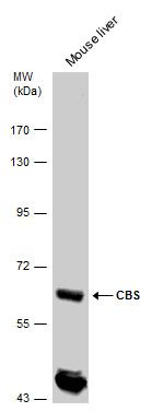 CBS antibody抗体，orb556849，biorb