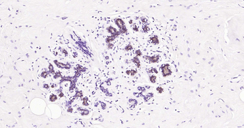 Tau-4 Mouse Monoclonal Antibod