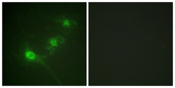 LKB1 (phospho Ser428) rabbit p