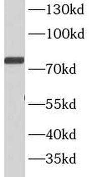 STAT4 Antibody抗体,orb631569,bio