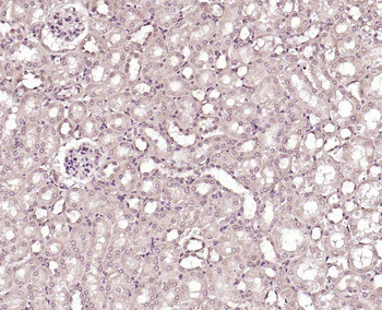 PLA2R Rabbit Polyclonal Antibo