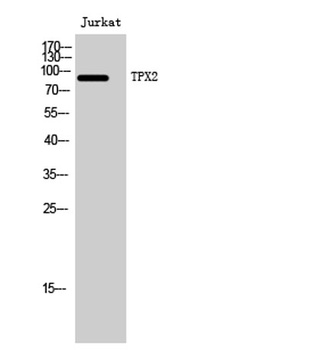TPX2 rabbit pAb抗体，orb768155，bi
