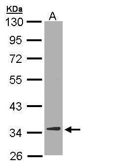 DECR1 antibody [N1C3]抗体，orb556