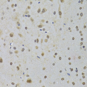 DDX1 Antibody抗体，orb1256922，bio