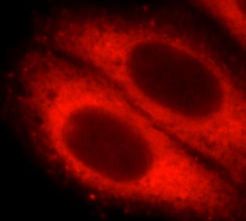 STX12 Antibody抗体，orb631681，bio