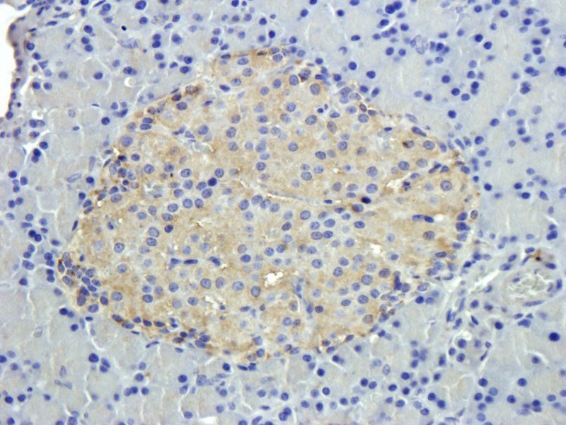 CD20 antibody抗体，orb10307，biorb