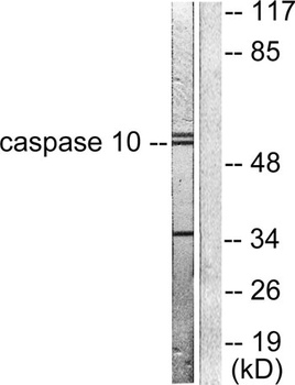 Caspase-10 B/D rabbit pAb抗体，or