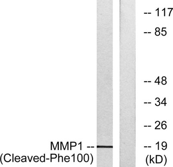 Cleaved-MMP-1 22k (F100) rabbi