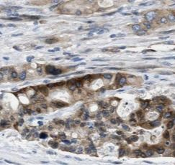 STXBP4 Antibody抗体，orb631622，bi