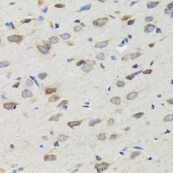 SIAH1 Antibody抗体，orb1258154，bi