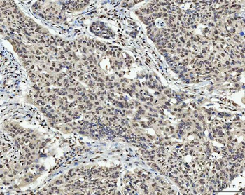 AREB6/ZEB1 Antibody (monoclona