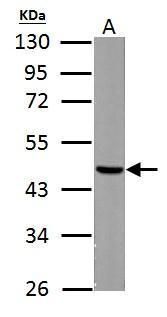 Fumarate hydratase antibody [N