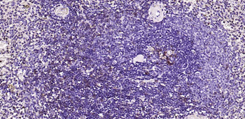 PD-1 Mouse Monoclonal Antibody