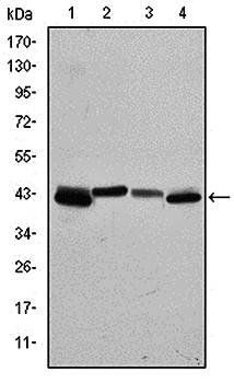 KRT19 Antibody抗体，orb97355，bior
