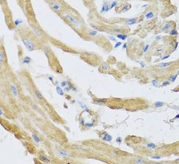 SFRP4 Antibody抗体,orb631112,bio