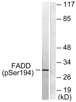 FADD (phospho Ser194) rabbit p