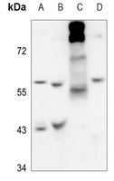 Arylsulfatase B Antibody抗体，orb