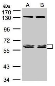 DNAJC7 antibody [N2C3]抗体，orb55