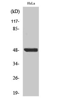 IκB-β (phospho Ser23) rabbit p
