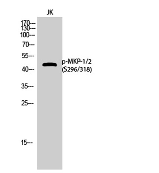 MKP-1/2 (phospho Ser296/318) r