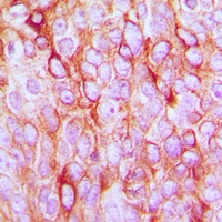 TGF alpha Antibody抗体,orb214660