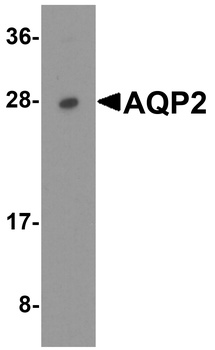 AQP2 Antibody抗体，orb1240211，bio