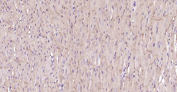 ATP1B1 Recombinant Rabbit Mono