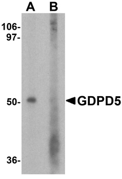 GDPD5 Antibody抗体,orb1239758,bi