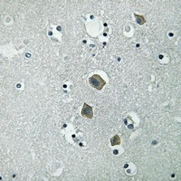 JAK2 (Phospho-Y570) Antibody抗体