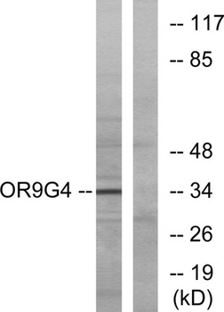 Olfactory receptor 9G4 rabbit 