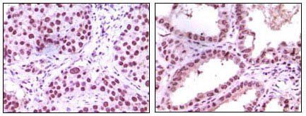 LSD1/AOF2 Antibody抗体，orb69054，