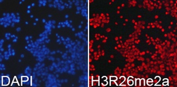 Asymmetric DiMethyl-Histone H3