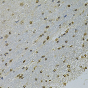 NLK Antibody抗体,orb1254644,bior