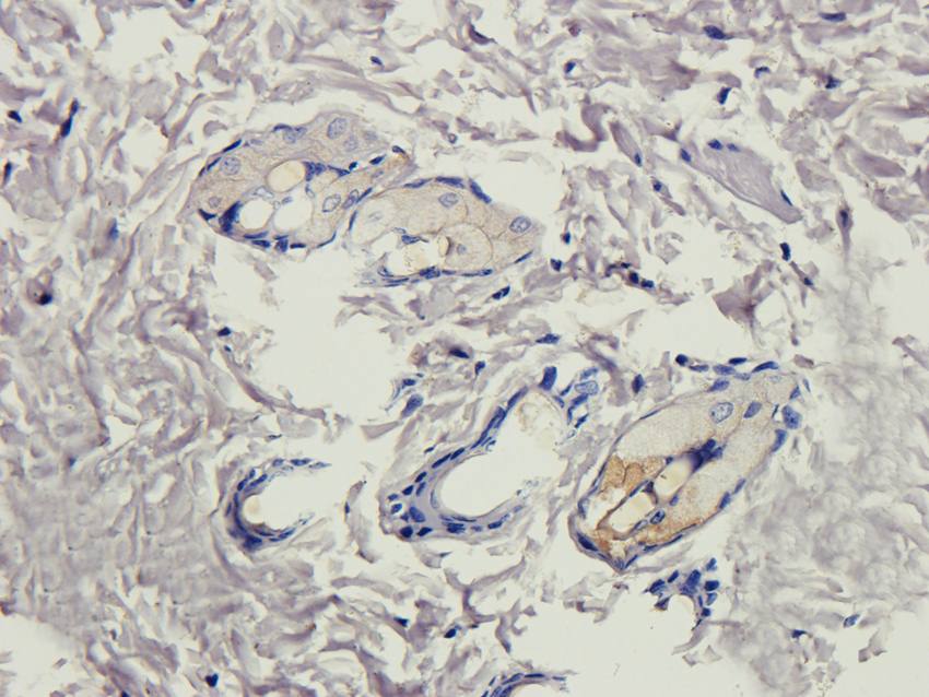 Collagen 4 alpha 1 antibody抗体,