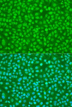 SFRS9 Antibody抗体，orb1257208，bi