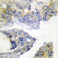 ILKAP Antibody抗体，orb665759，bio