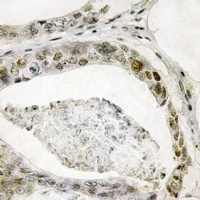 SMAD3 (Phospho-S208) Antibody抗