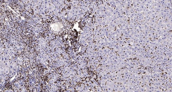 MSK1 (phospho Ser376) rabbit p