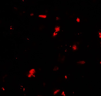 GRK6 Antibody抗体，orb1239726，bio