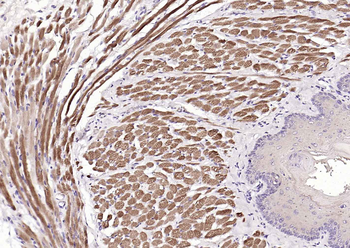 MYH1 Rabbit Polyclonal Antibod