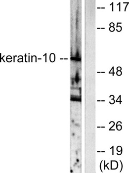Cytokeratin 10 rabbit pAb抗体，or