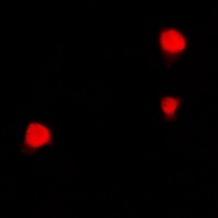 ZNF23 Antibody抗体,orb665738,bio