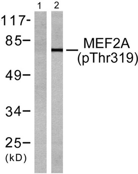 MEF-2 (phospho Thr319) rabbit 