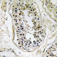 pro-BMP8 Antibody抗体，orb665829，