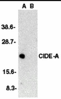 CIDE-A Antibody抗体，orb1239982，b