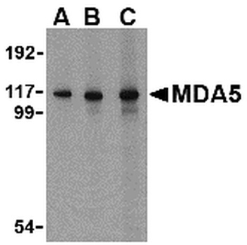 MDA5 Antibody抗体，orb1238796，bio