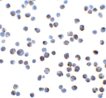 DR4 Antibody抗体，orb1239343，bior